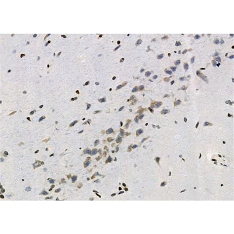 asc2 antibody|ASC2 Antibodies .